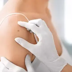 Doctor looking at mole on skin